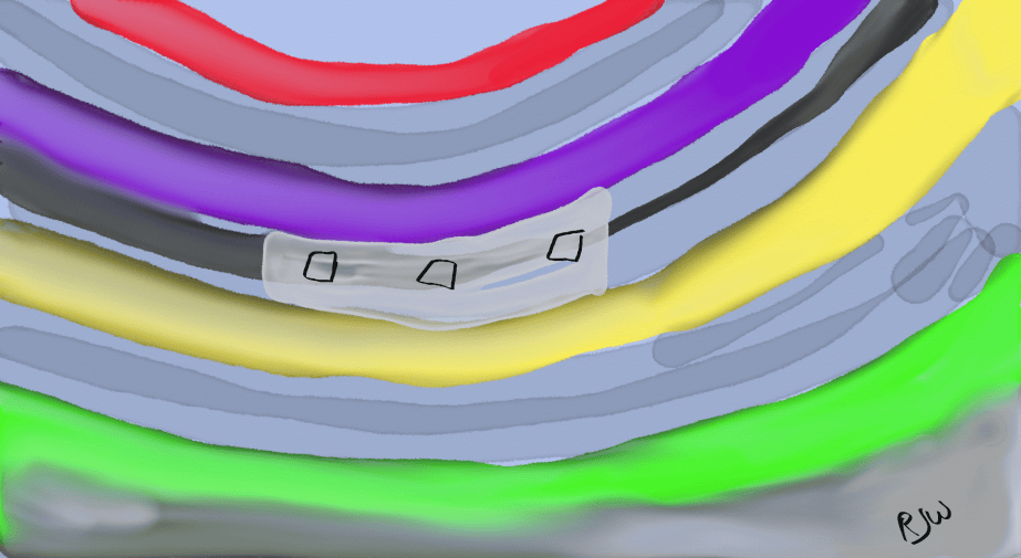 DD28 – Guggenheim Fish&nbsp;Bowl