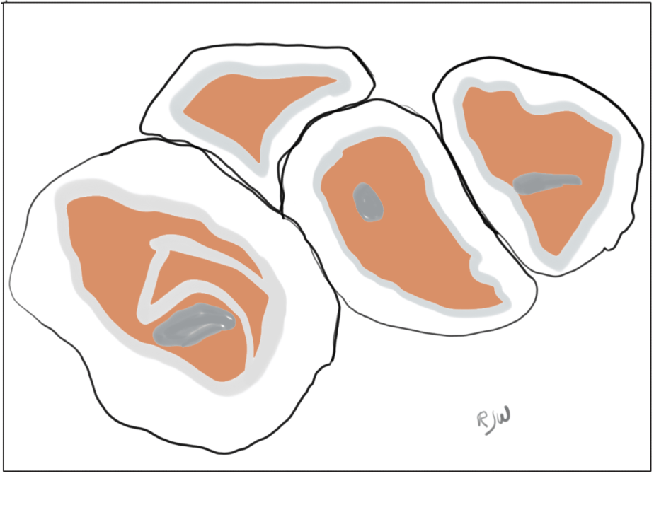 DD29 – Empty&nbsp;Shells